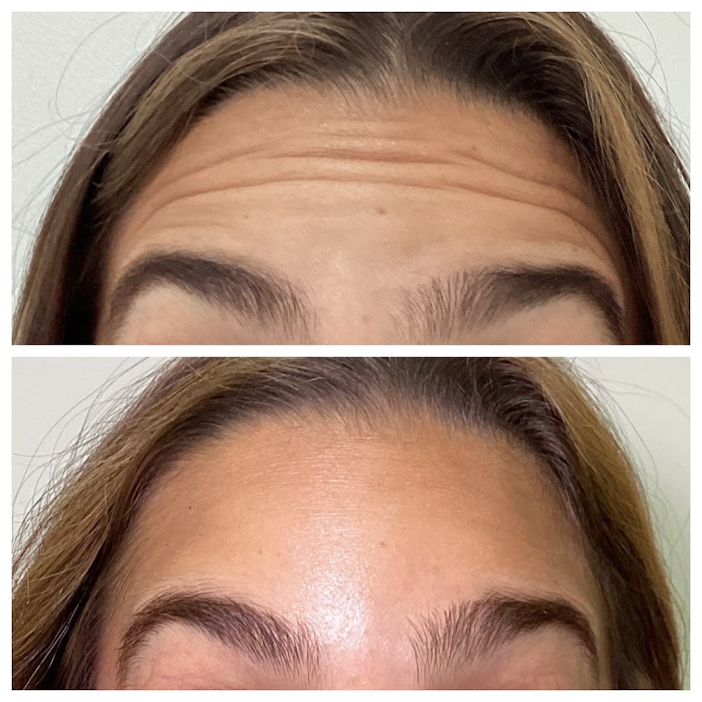 Rejuvenate by Silvia, APRN